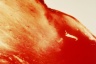 Blood and Semen V