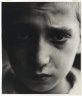Malnutrition (New York)