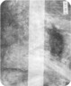 Brooklyn Museum: Portrait of Mlle Fiocre in the Ballet 