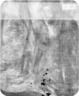 Brooklyn Museum: Portrait of Mlle Fiocre in the Ballet 