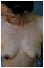 Brooklyn Museum: 99 Needles